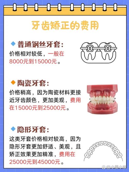 矫正牙齿钢丝价格差异大吗？一般多少钱？-图3