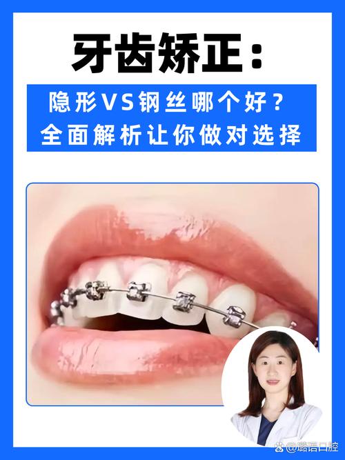 牙齿矫正真的有必要吗？关键看你的需求和生活质量-图2