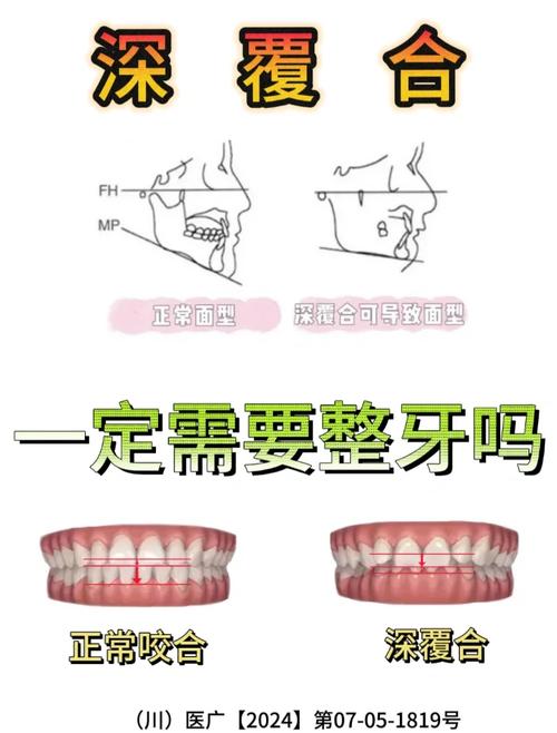 牙齿矫正真的有必要吗？关键看你的需求和生活质量-图3