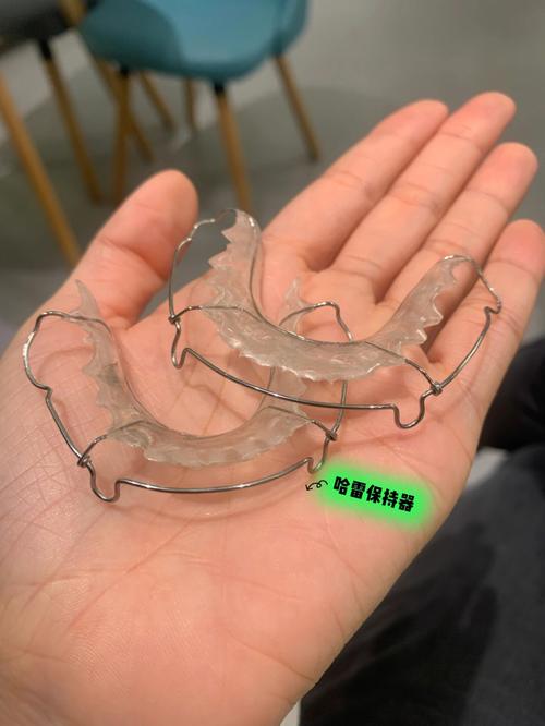 成都隐适美矫正牙齿效果如何?值得选吗?-图1 成都隐适美矫正牙齿效果如何?值得选吗?-图1