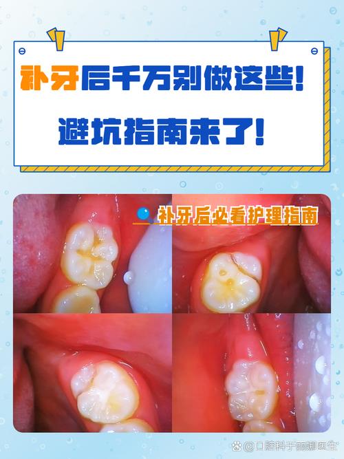 补牙后能矫正牙齿吗-图1 补牙后能矫正牙齿吗-图1