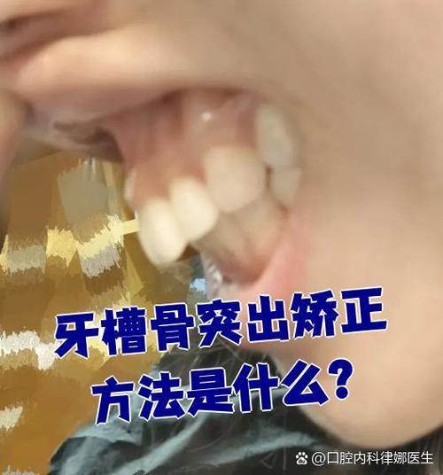 矫正牙齿会导致牙槽骨突出吗？-图3