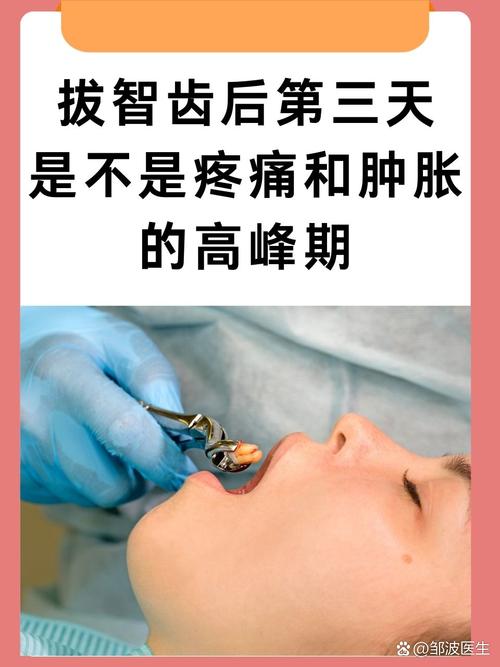 矫正牙齿拔智齿的过程痛吗？-图2