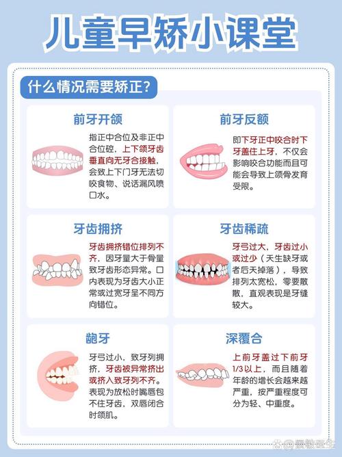 小孩矫正牙齿的危害-图3 小孩矫正牙齿的危害-图3