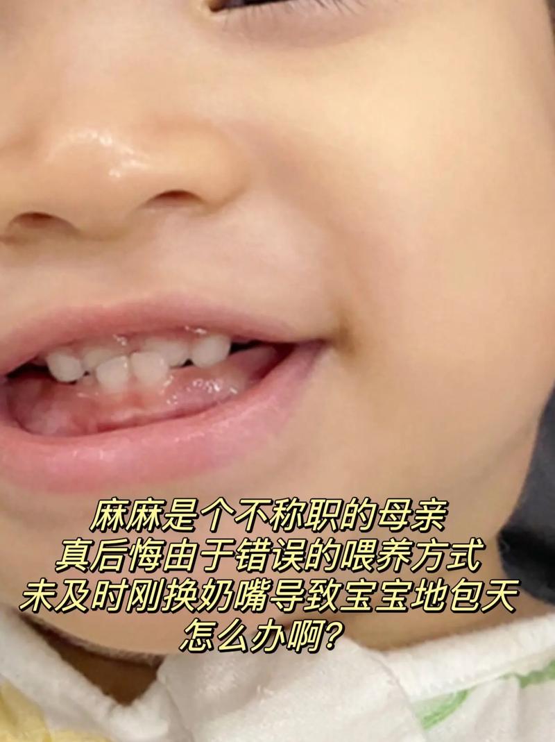 喂奶能帮助矫正牙齿吗?-图3 喂奶能帮助矫正牙齿吗?-图3