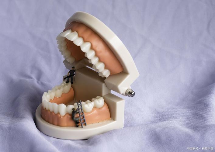 德国矫正牙齿新技术-图2