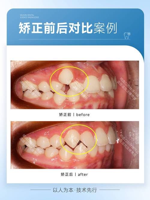 江阴矫正牙齿哪里好-图1
