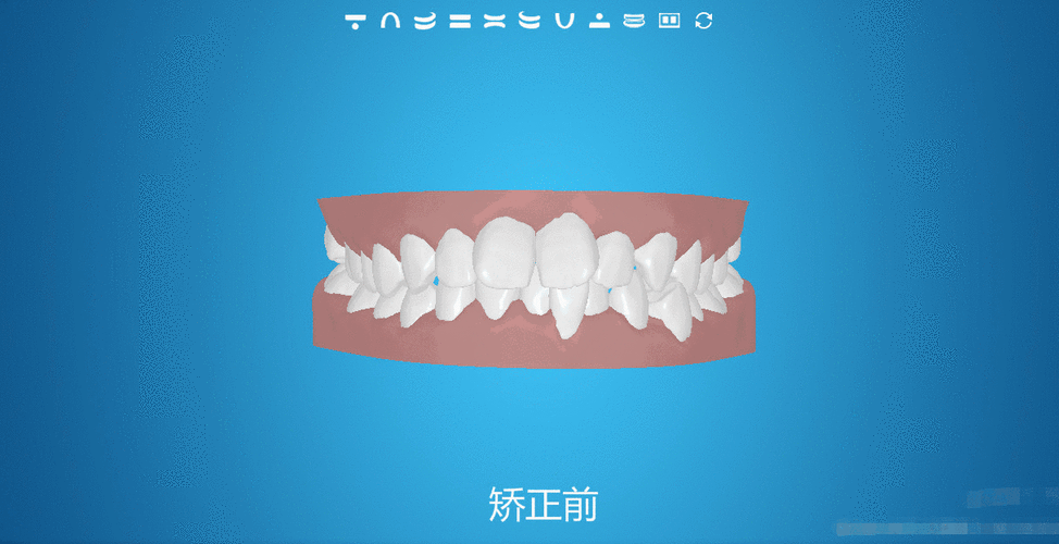 2025肇庆牙齿矫正哪家好？求专业靠谱机构推荐！-图2