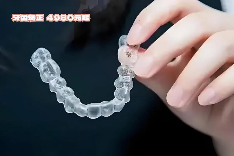 虎门矫正牙齿哪里好?靠谱机构怎么选?-图2 虎门矫正牙齿哪里好?靠谱机构怎么选?-图2