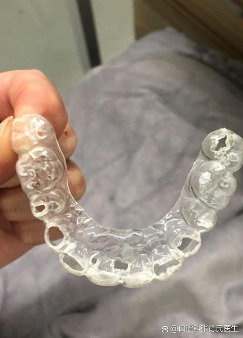 虎门矫正牙齿哪里好?靠谱机构怎么选?-图3 虎门矫正牙齿哪里好?靠谱机构怎么选?-图3