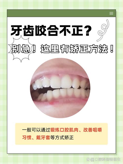 牙齿矫正后不能咬合-图1