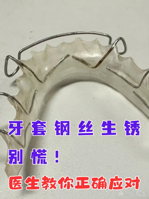 矫正牙齿的记忆钢丝-图1 矫正牙齿的记忆钢丝-图1