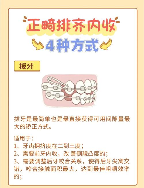 牙齿矫正怎么收牙缝？有哪些实用方法？-图1