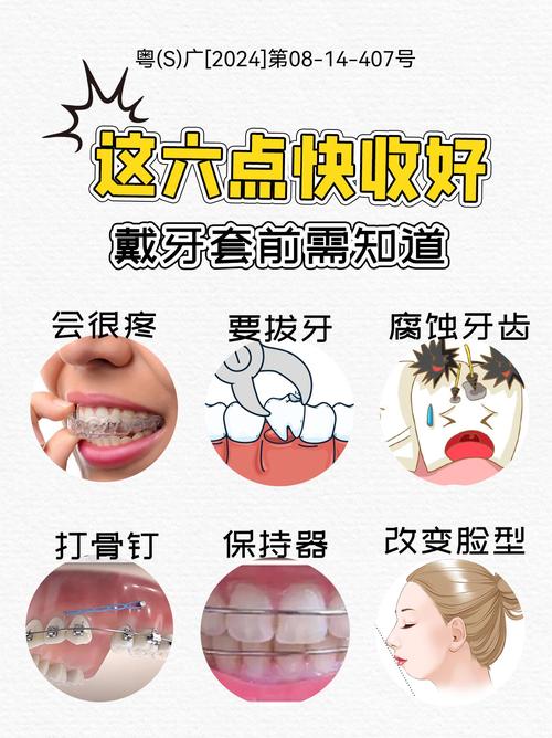 牙齿矫正过程中有哪些容易被忽略的注意事项？-图2