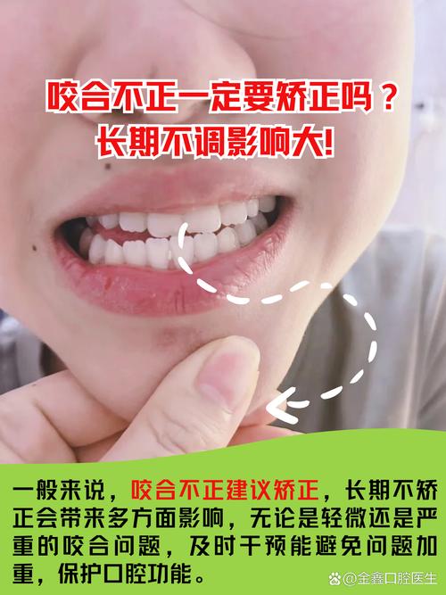 牙齿矫正中咬合不好-图1