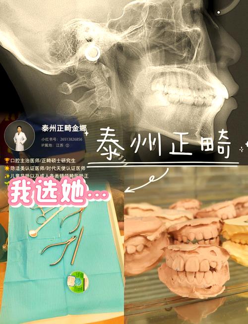 泰州牙齿矫正去哪儿做好？求推荐靠谱机构与医生？-图2