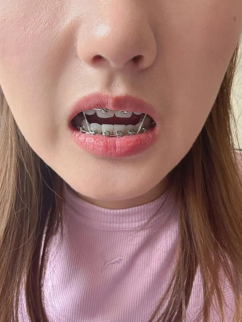 北京矫正牙齿哪家好?专业机构怎么选?-图1 北京矫正牙齿哪家好?专业机构怎么选?-图1