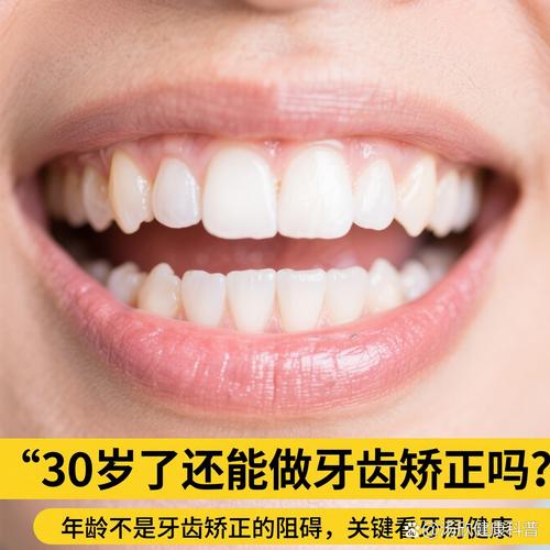 三十岁矫正牙齿还来得及吗？-图3