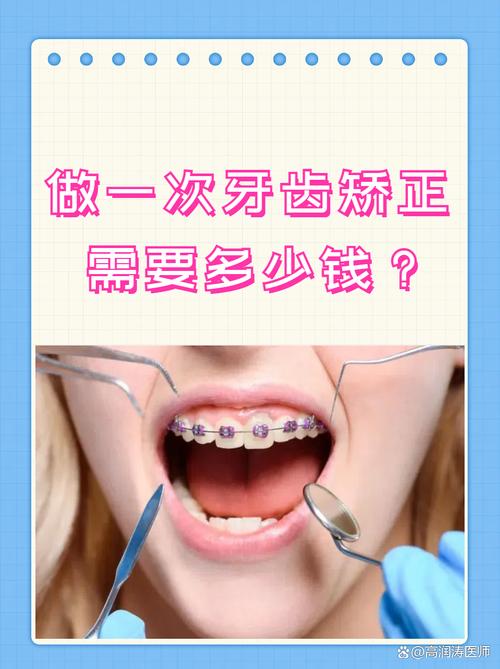 矫正牙齿咨询要钱吗？免费咨询吗？-图2
