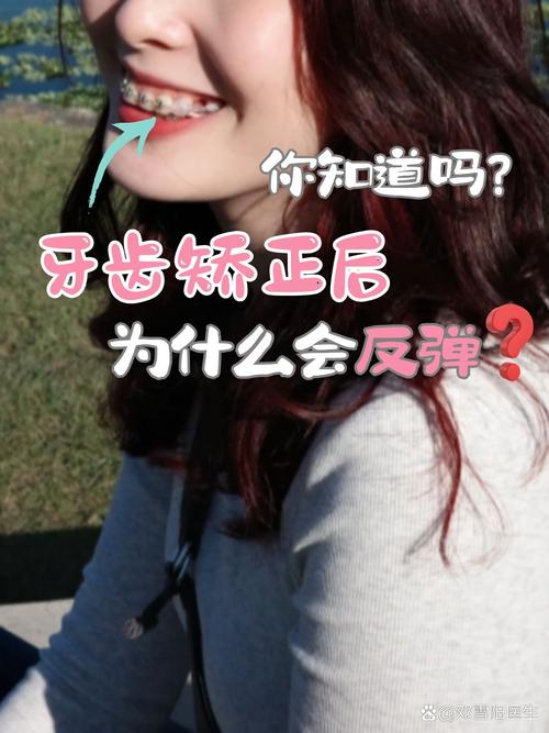 牙齿矫正会改变鼻子-图1 牙齿矫正会改变鼻子-图1