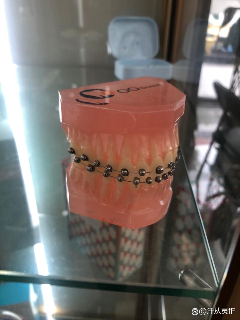 北海牙博士牙齿矫正怎么样？效果、价格和服务如何？-图1