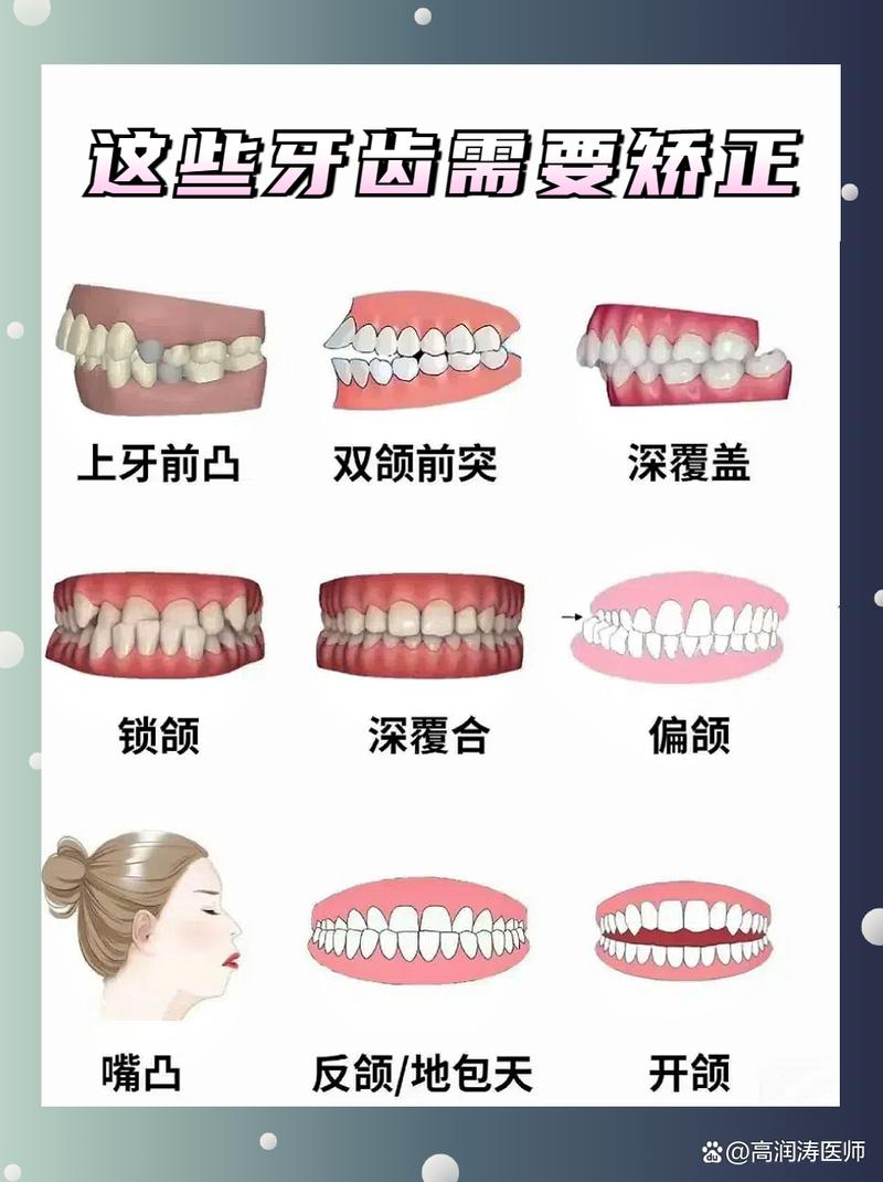 矫正牙齿去哪儿矫正效果最好？专业机构怎么选？-图3