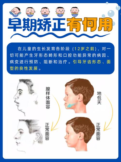 儿童矫正牙齿过程会难受吗？孩子能适应吗？-图3