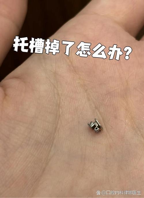 矫正牙齿托槽松了该如何处理?-图2 矫正牙齿托槽松了该如何处理?-图2