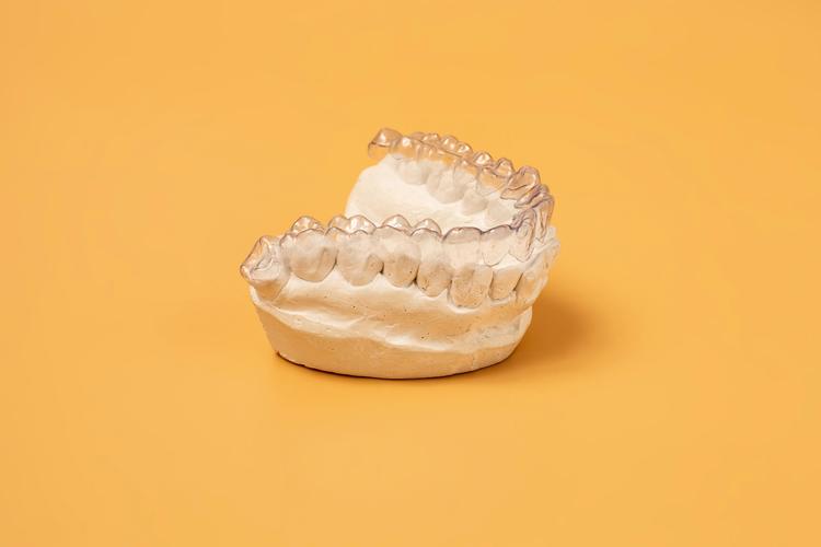 陶瓷全隐形矫正牙齿，真的隐形又有效吗？-图2