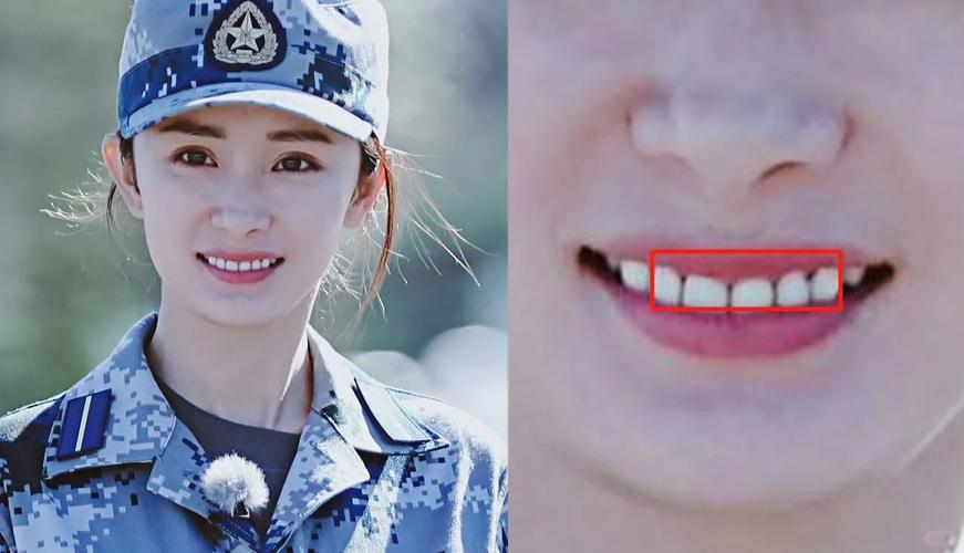 矫正牙齿会让牙齿变黑吗?-图3 矫正牙齿会让牙齿变黑吗?-图3