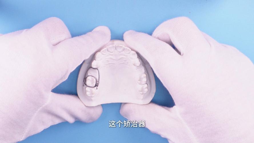牙齿矫正不用矫正器？这些新方法靠谱吗？-图2