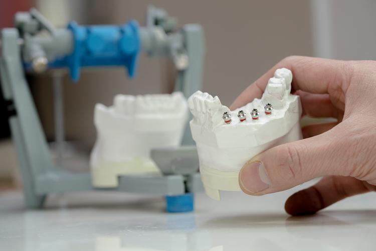 3D打印牙齿矫正器相比传统有何矫正优势？-图1