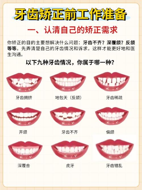 矫正牙齿一年能完成吗？时间够用吗？-图1