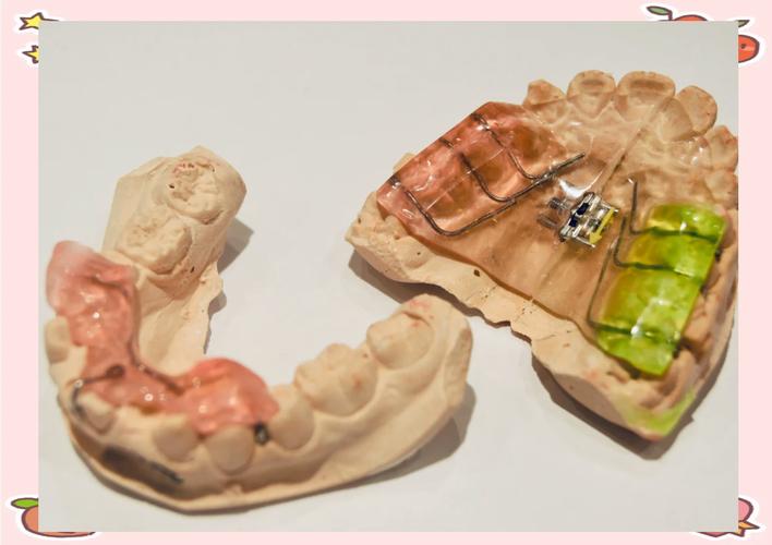 隐形成人牙齿矫正器真的既隐形又有效吗？-图2