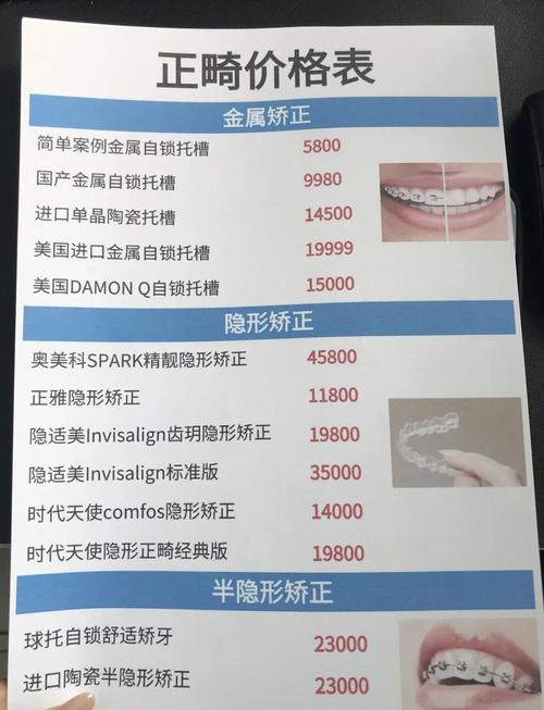 牙齿矫正费用大概多少？-图1