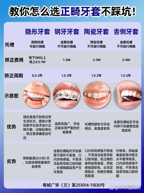 牙齿矫正费用大概多少？-图3