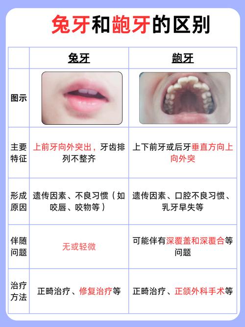 兔牙齿矫正前后图片,矫正效果究竟如何?-图1 兔牙齿矫正前后图片,矫正效果究竟如何?-图1