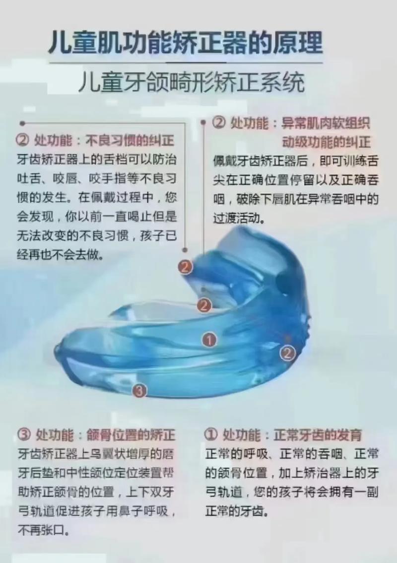 如何正确使用牙齿矫正器?佩戴时间与清洁注意事项有哪些?-图1 如何正确使用牙齿矫正器?佩戴时间与清洁注意事项有哪些?-图1