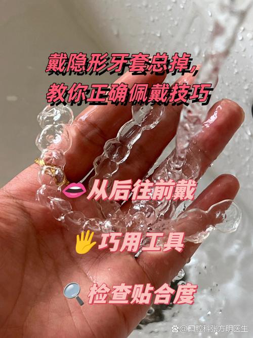 牙齿矫正器佩戴时会掉下来吗?-图2 牙齿矫正器佩戴时会掉下来吗?-图2
