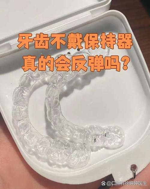 牙齿矫正器佩戴时会掉下来吗?-图3 牙齿矫正器佩戴时会掉下来吗?-图3