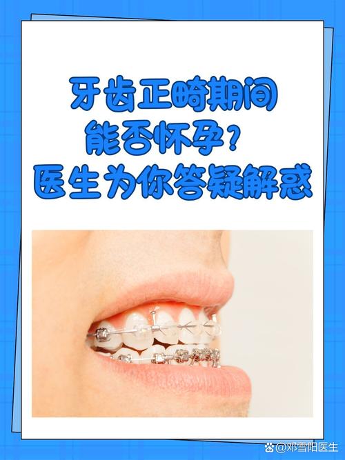 牙齿矫正中途怀孕，矫正还能继续吗？对胎儿有影响吗？-图1