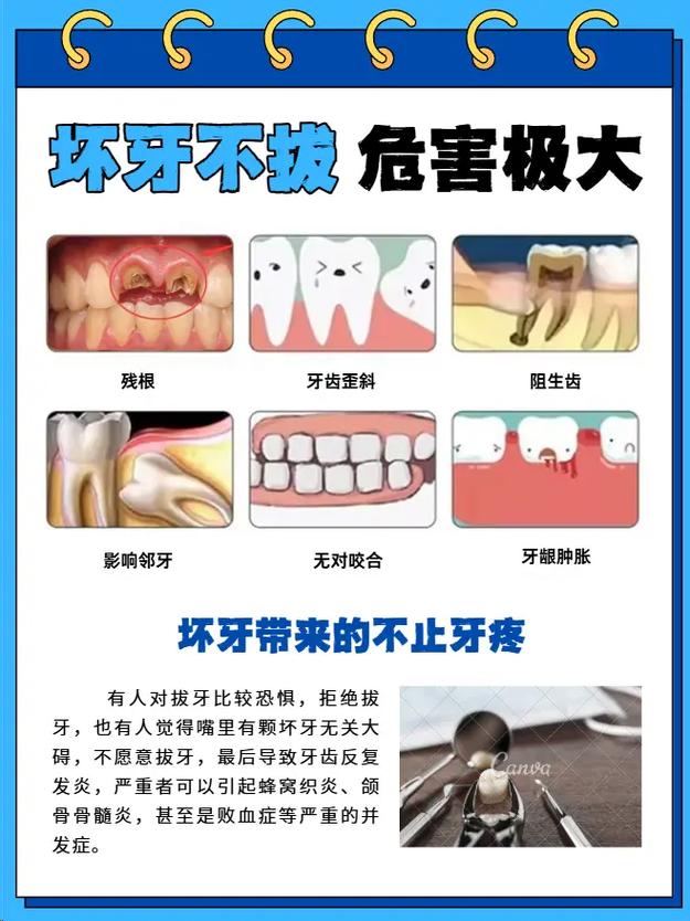有烂牙能矫正牙齿吗？烂牙状态下矫正可行吗？-图2