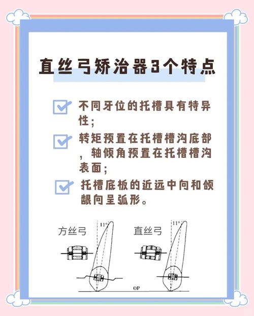 矫正牙齿换弓丝,一般要换几次?哪种更合适?-图2 矫正牙齿换弓丝,一般要换几次?哪种更合适?-图2