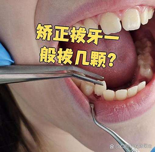 牙齿矫正拔牙，到底该拔哪颗牙齿？-图3