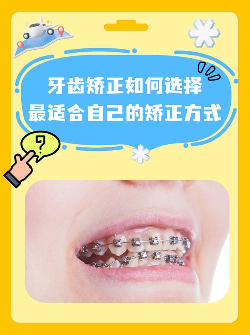 北京牙齿矫正去哪好？这几家口碑机构值得选吗？-图3