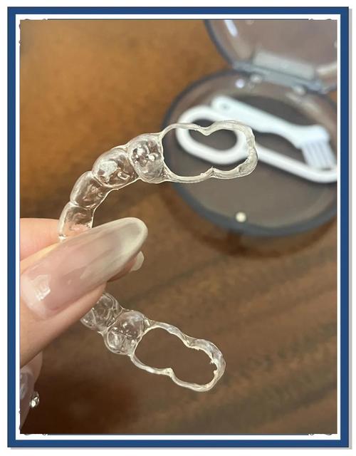 牙齿矫正后透明牙套，效果护理佩戴要注意啥？-图2