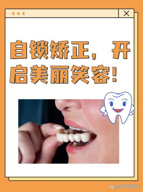 牙齿锁合矫正一般需要多长时间？-图1