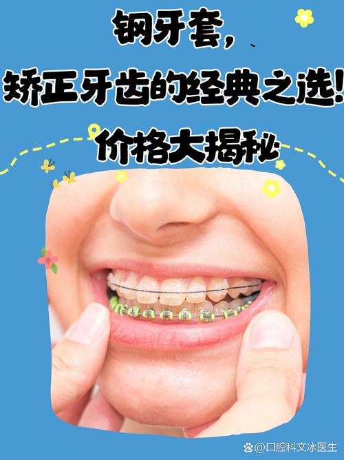 银川牙齿矫正去哪好-图1