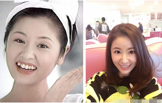 明星牙齿矫正对比图-图2