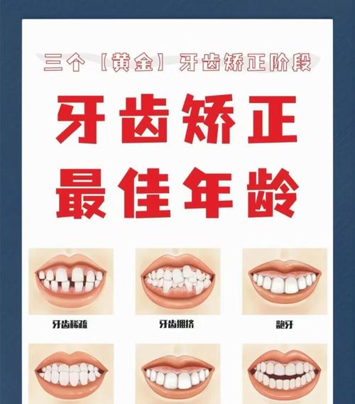 矫正牙齿的最佳年龄阶段是何时？不同年龄矫正效果有别吗？-图1